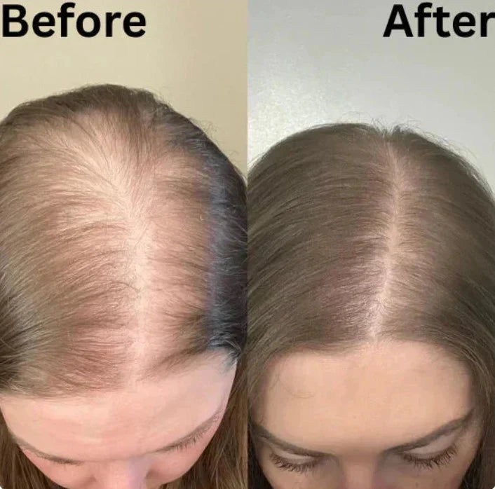 Rosemary Shampoo